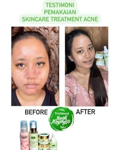 Pengguna Amorannisa Skincare
